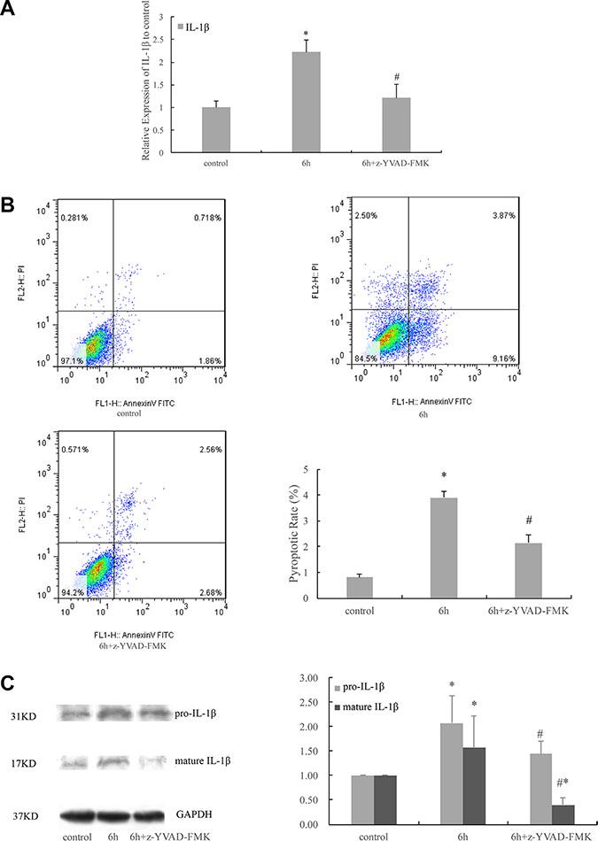 Cyclic stretch-induced expression of IL-1&#x03B2; and pyroptosis were caspase-1 dependent.