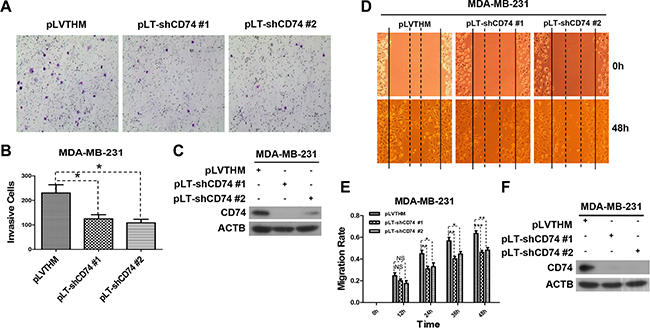 CD74 knockdown inhibited cell migration.