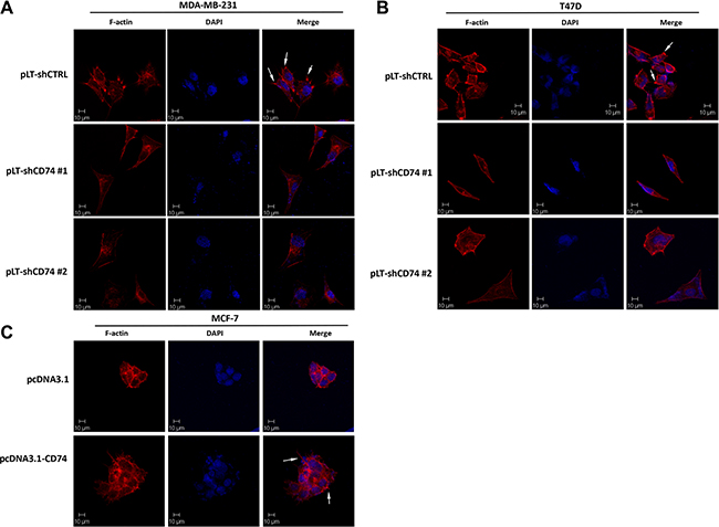 CD74 promoted protrusion formation in breast cancer cells.