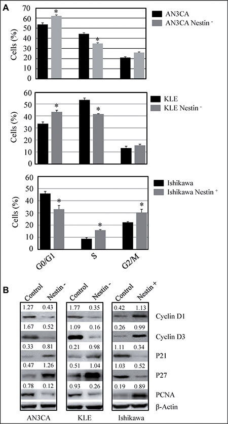 Nestin knockdown suppresses and overexpression enhances cell cycle progression.