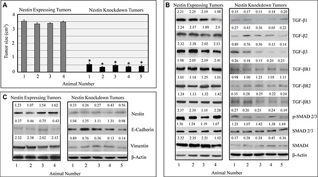 Nestin knockdown inhibits in vivo tumorigenesis.
