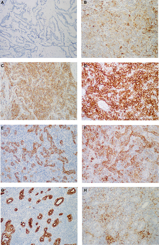 Representative images of PD-L1 immunostaining.