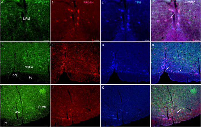 Triple fluorphor expression in the ventral brainstem 5 days after renal PRV-614 injection of MC4R-GFP transgenic mice.