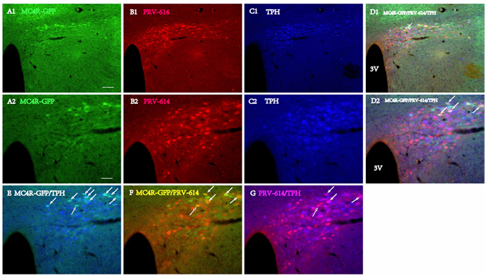 Triple fluorophor Expression in Diencephalon and the paraventricular hypothalamic nucleus (PVN) 6 days after renal PRV-614 injection of MC4R-GFP transgenic mice.