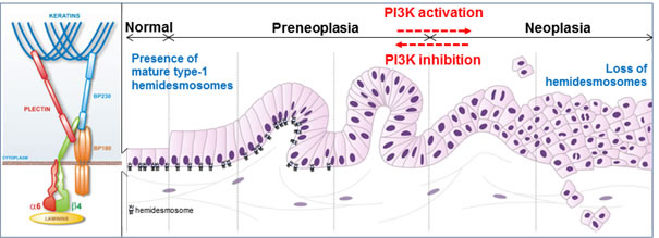 PI3K-dependent loss of hemidesmosomes during pancreatic tumorigenesis. Pancreatic tumorigenesis progresses from preneoplasic to neoplasic lesions. Mature type-1 hemidesmosomes anchor epithelial pancreatic duct cells to the underlying basement membrane: transmembrane integrin α6β4 and BP180 (bullous pemphigoid) bind to laminins in the basement membrane, and intracellular hemidesmosome stabilization occurs via their association with keratins through the two plakins, plectin and BP230. PI3K activation during incipient pancreatic neoplasia induces the disassembly of these anchoring complexes, and therefore represents a druggable target to inhibit pancreatic cell migration and invasion through restoration of hemidesmosomes.