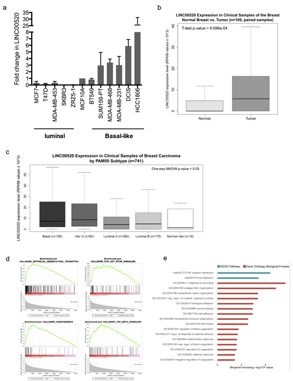 Expression Analysis in Clinical Samples of Human Breast Invasive Carcinoma.