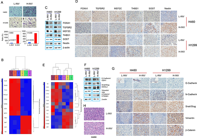 Differential expression of invasion-related genes and EMT regulators in H-INV and L-INV cells.