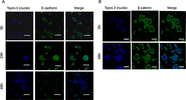 Regulation of E-cadherin and &#x03B2;-catenin localization and stability by JWH-133 0.1 &#x03BC;M treatment.