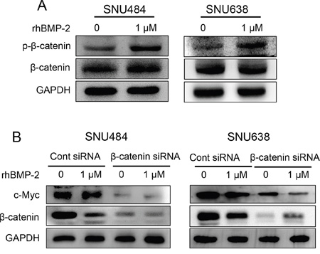 Validation of &#x03B2;-catenin expression after treatment of gastric cancer cells with rhBMP-2.