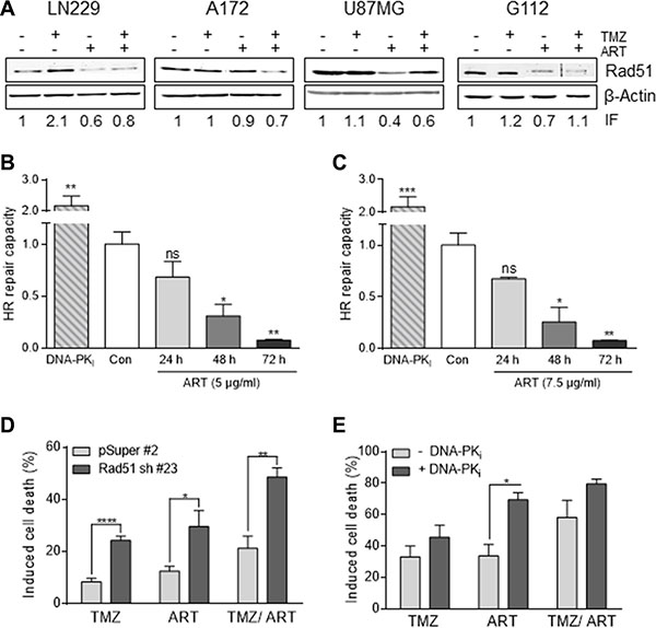 Impact of ART and/or combined treatment on HR/NHEJ in glioblastoma cells.