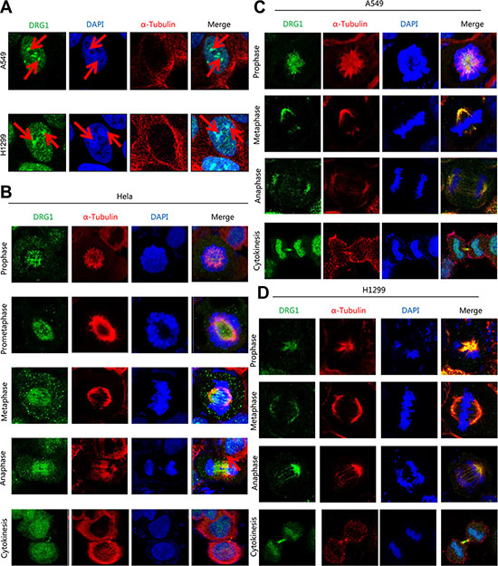 DRG1 is a spindle-associated protein.