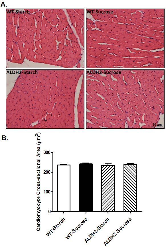 Effect of 8 weeks of sucrose diet (starch as control diet) intake on histological property in WT and ALDH2 transgenic mice.