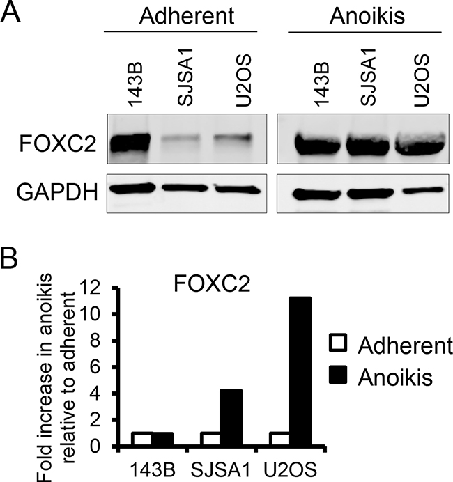 Anoikis increases FOXC2 levels.