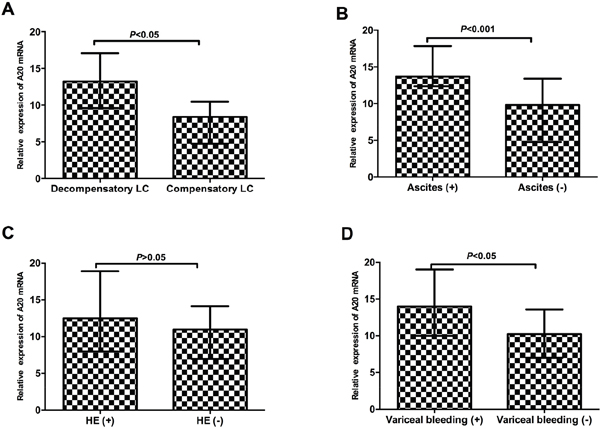 The correlations between A20 mRNA and the common complications of liver cirrhosis.