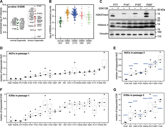 Organoids from different CRC tumors respond differently to chemical EZH2 inhibition.