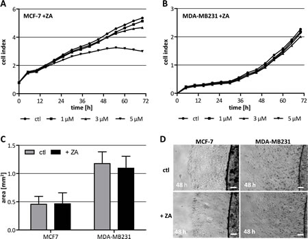 Cytotoxicity of ZA on breast cancer cells.