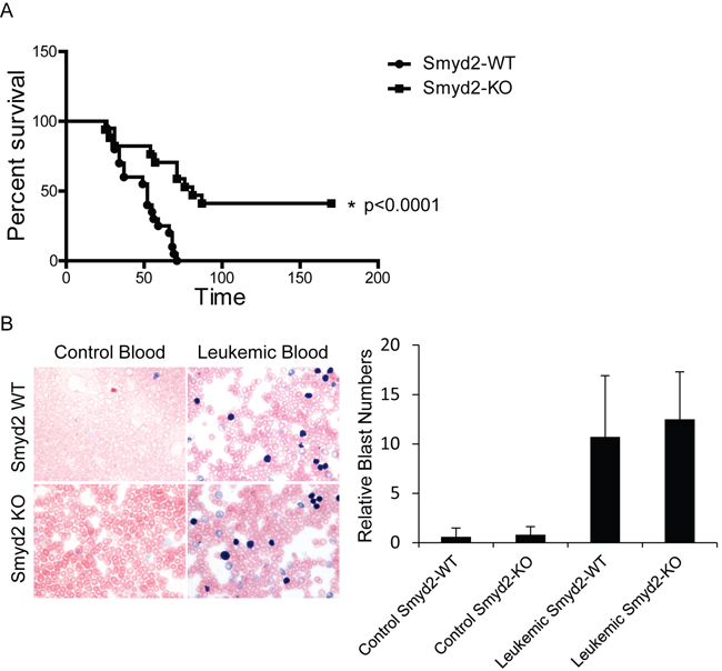 Smyd2 deletion impairs MLL-AF9/NRas