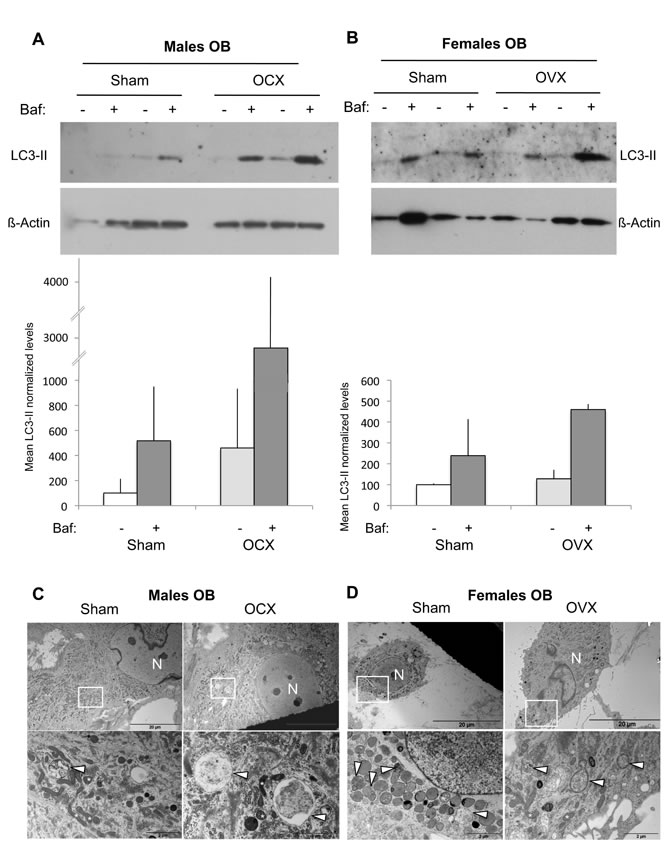 Autophagic activity in OB from gonadectomized mice.