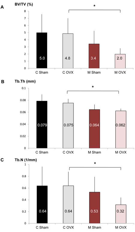 Effect of autophagy deficiency in OB on bone phenotype induced by aging and ovariectomy.