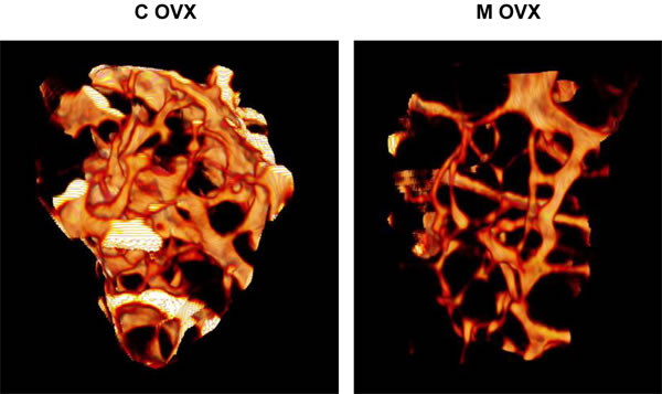 Illustration of 3D reconstructions of trabecular bone from ovariectomized control and mutant mouse using microCT.