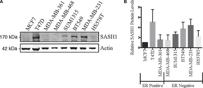 SASH1 protein expression in breast cancer cell lines.