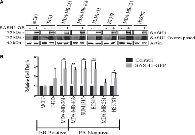Ectopic SASH1 expression increases cell death.