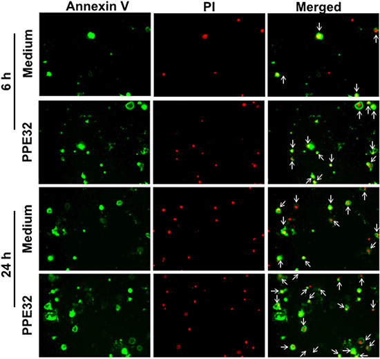 Induction of apoptosis in PPE32 stimulated THP-1 macrophages.