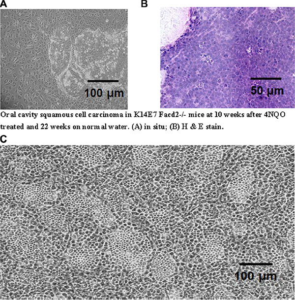 Comparison of morphology of explanted oral cavity tumor from a 4-NQO treated K14E7 Fancd2&#x2212;/&#x2212; mouse with IL-3 cultured cells from LTBMCs.
