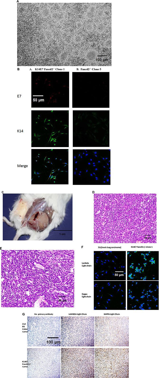 Morphology and immunohistochemistry for immunoglobulin kappa and lambda light chain in K14E7 Fancd2&#x2212;/&#x2212; clone 1 IL-3-dependent tumor forming cell lines.