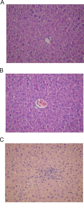 Histological changes in liver encountered after treatment with miR-205-LNA-inhibitor;