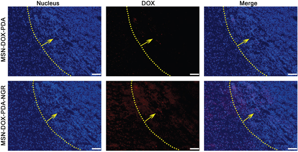 In vivo distribution of different DOX formulations in brains of glioma-bearing rats.