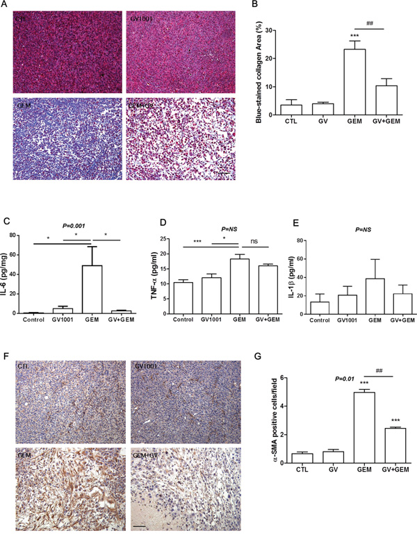 Changes of fibrosis in CD133+ AsPC1 xenograft mice.