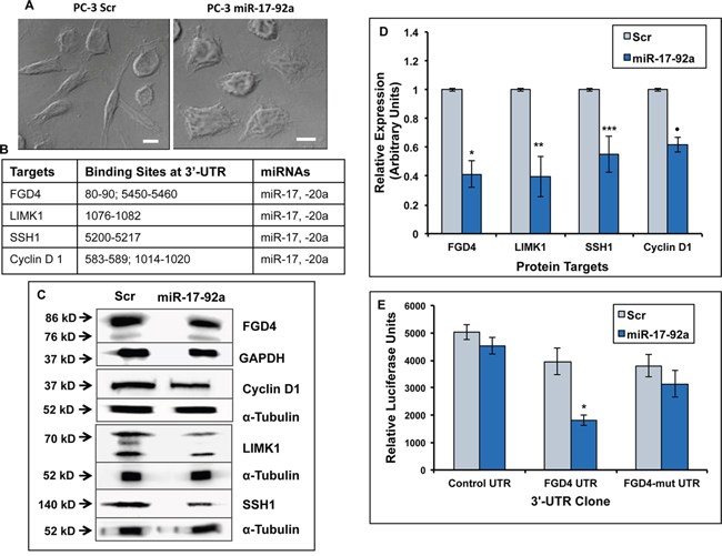 Expression of miR-17-92a cluster in prostate cancer cells altered cellular morphology and reduced expression of the putative target genes.