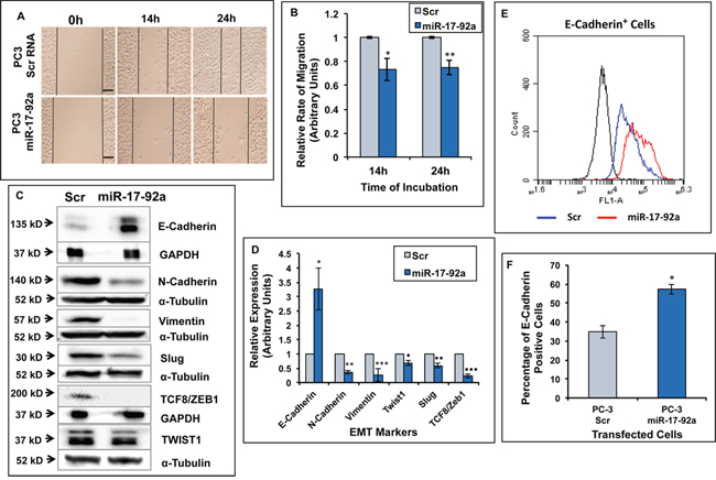 Expression of miR-17-92a cluster miRNAs inhibited migration and promoted an epithelial phenotype in prostate cancer cells.