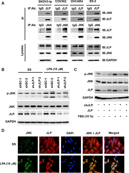 JLP-JNK interaction in ovarian cancer cell lines.