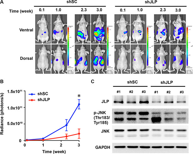 Knockdown of JLP represses ovarian xenograft tumor growth.