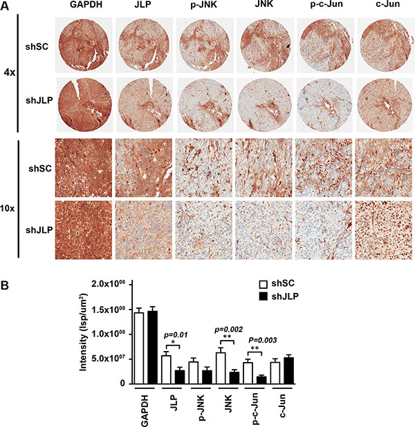 Knockdown of JLP attenuates the activation of JNK and c-Jun in ovarian cancer xenografts.