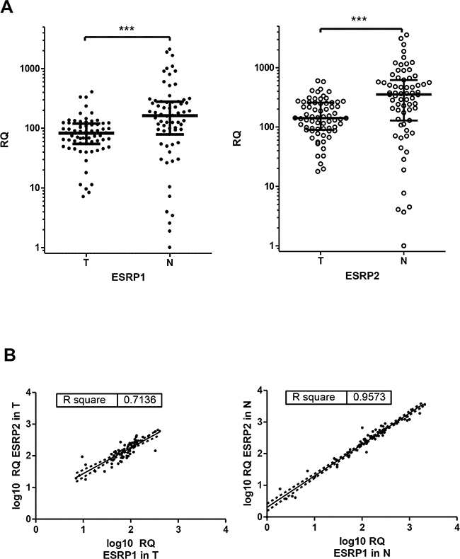 ESRP1 and ESRP2 expression in CRC.