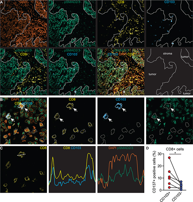 CD103&#x002B; TIL in situ are characterized by ongoing TCR and TGF&#x03B2;R1-signaling.