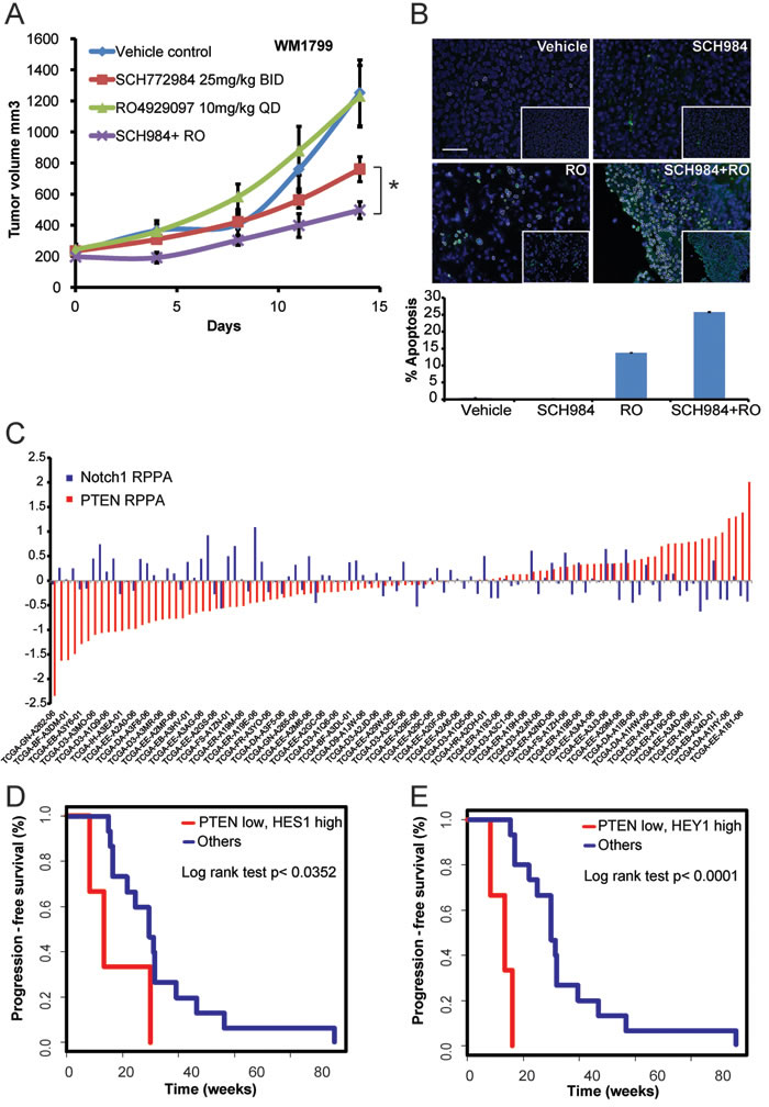 PTEN low and Notch high melanoma patients respond poorer to MAPK inhibitors.