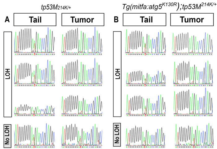 p53 loss of heterozygosity in MPNSTs arising in