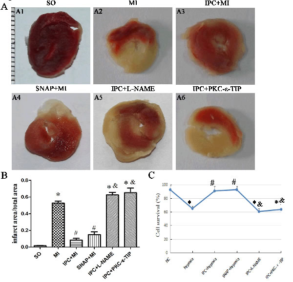 Effects of NO and PKC-&#x3b5; on IPC-induced cardioprotection