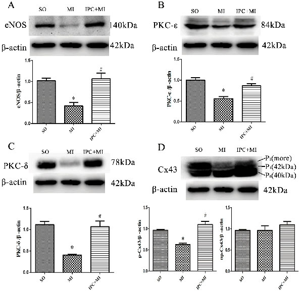 Molecular mechanisms of IPC-induced cardioprotection