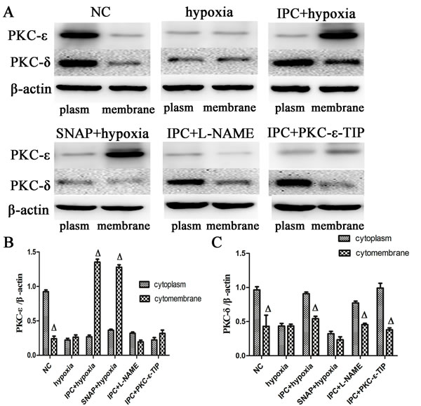 Altered PKC-&#x3b4; and PKC-&#x3b5; distribution after different interventions in vitro.