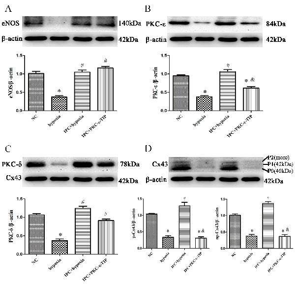 PKC-&#x3b5; was involved in IPC-induced cardioprotection in vitro.