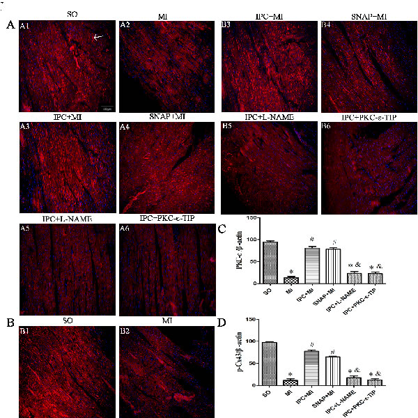 Effects NO and PKC-&#x3b5; on IPC-induced cardioprotection