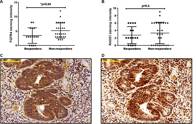 FGFR4 correlates with RAD51 protein levels and poor clinical outcome in human rectal cancer.