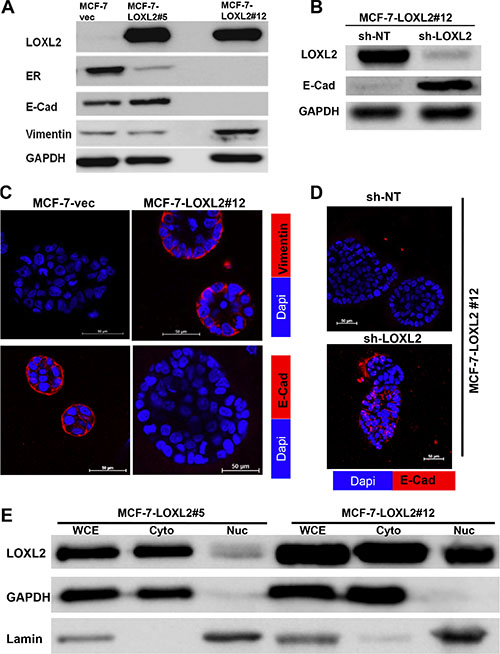 Characterization of MCF-7-LOXL2 cell lines for EMT and expression of luminal markers.