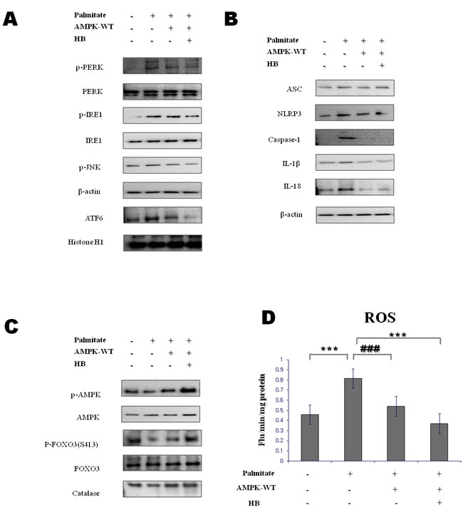 Effect of &#x3b2;-hydroxybutyrate on ER-stress-induced inflammasome formation