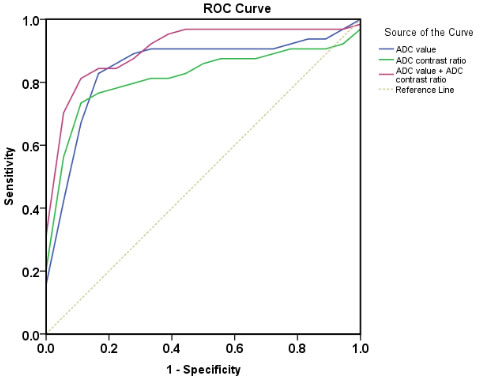 Receiver operating characteristic curves used to evaluate diagnostic performance of ADC value, ADC contrast ratio and combined of them, respectively (area under ROC: 0.852 &plusmn; 0.059, 0.821 &plusmn; 0.061, and 0.913 &plusmn; 0.041) for differentiation between pancreatic carcinoma and mass-forming focal pancreatitis.